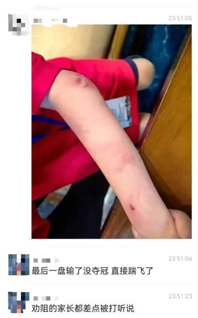 杭州9岁围棋少年疑遭父亲家暴跳楼身亡，相关部门：仍在调查中  第1张